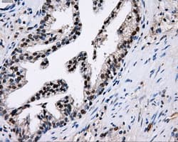 PKMYT1 Antibody (clone OTI5E1)