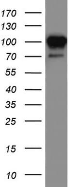 Monoclonal Mouse anti-Human MCAM / CD146 Antibody (clone UMAB154, Carrier-free, IHC, WB)