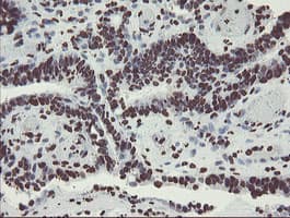 NONO / P54NRB Antibody (aa184-385, clone OTI5F1)