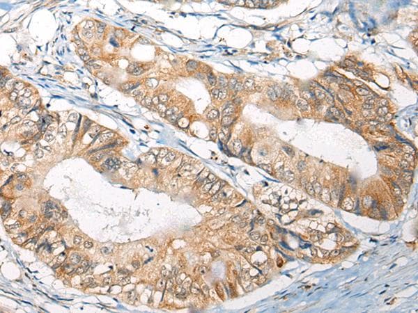 B4GAT1 / B3GNT1 Antibody