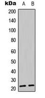 BIK Antibody (phospho-Thr33)