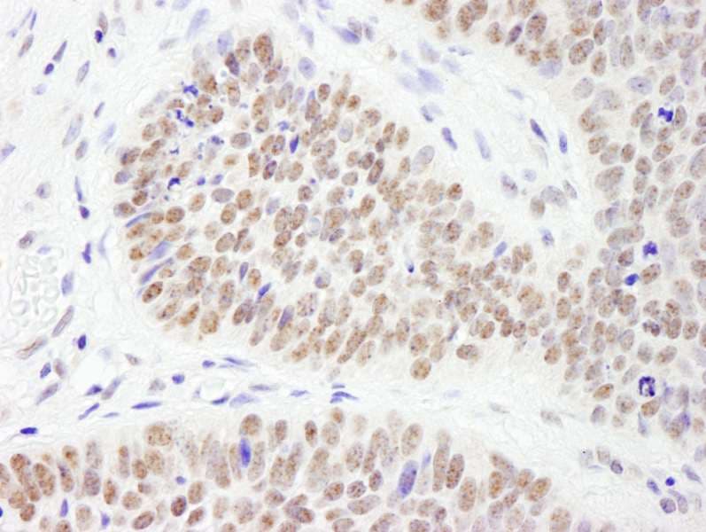 PHF6 Antibody (aa315-365)