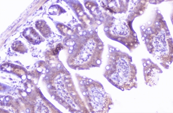 Polyclonal Rabbit anti-Human CTTN / Cortactin Antibody (IHC, IF, WB)