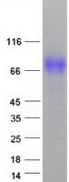 Human Tyrosinase Protein (Recombinant Myc-DDK (Flag))
