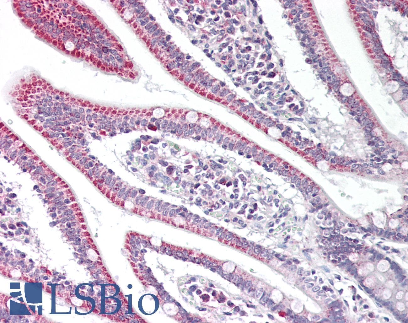 Polyclonal Rabbit anti-Human REV3L / REV3 Antibody (aa246-285, IHC, IF, WB)