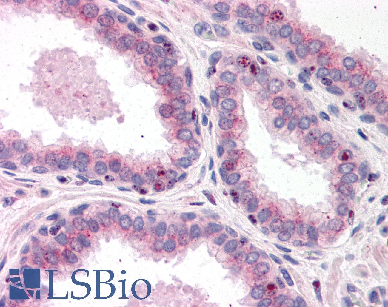 IHC-plus™ LPAR2 / EDG4 Antibody (aa18-32)