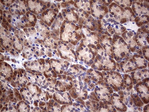 PIK3CA / PI3K Alpha Antibody (aa303-631, clone OTI6D1)