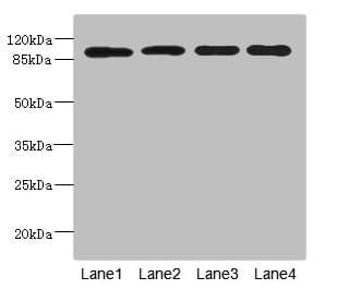 Polyclonal Rabbit anti-Human USP26 Antibody (IHC, WB)