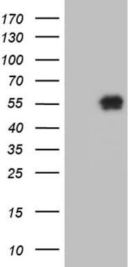 Monoclonal Mouse anti-Human KLF12 Antibody (clone OTI3D4, WB)