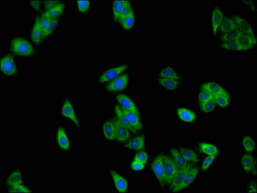 SLC37A2 Antibody