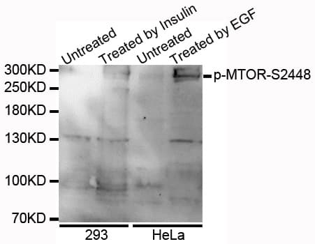 Polyclonal Rabbit anti-Human MTOR Antibody (phospho-Ser2448, WB)