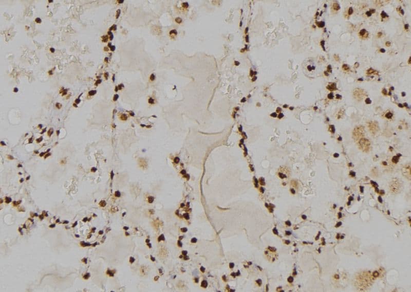 TOLLIP Antibody