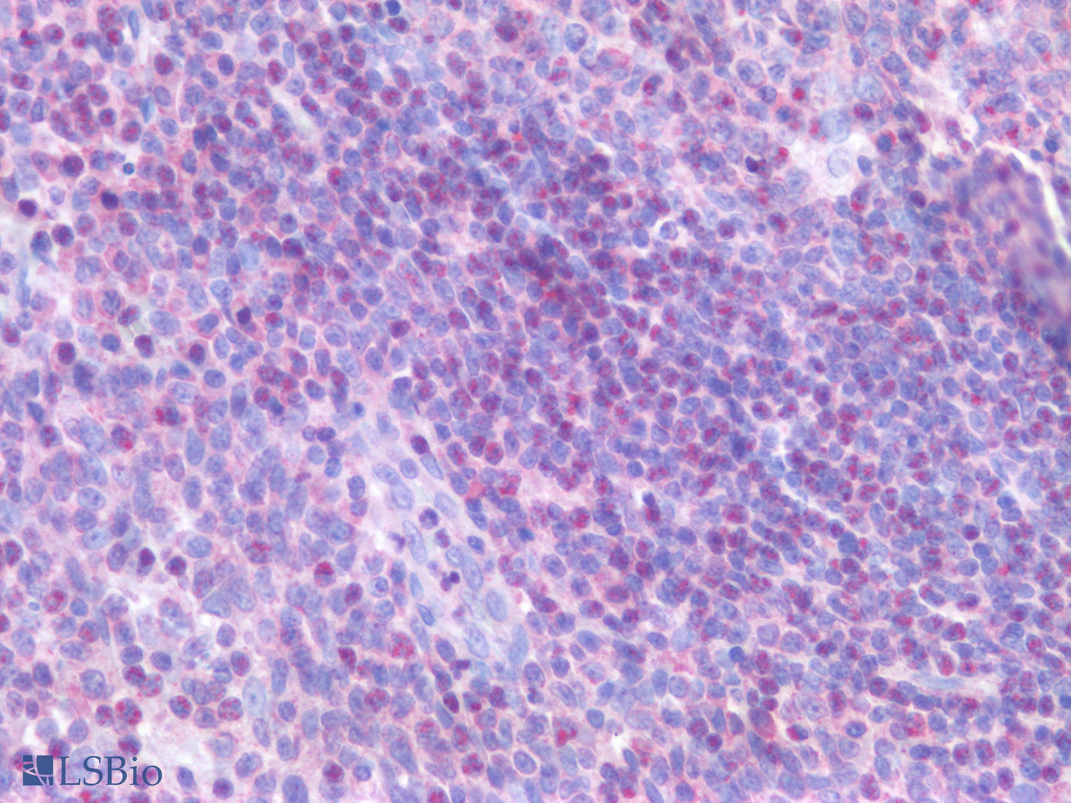 PathPlus™ PTP1B Antibody