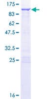 Human CACNB1 Protein (Recombinant GST)