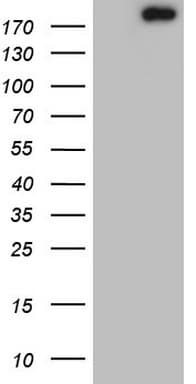 TOP2A / Topoisomerase II Alpha Antibody (aa1100-1531, clone OTI19D4)