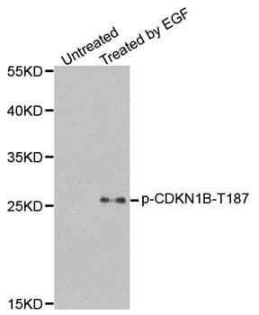 CDKN1B / p27 Kip1 Antibody (phospho-Thr187)