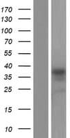 Human ARMCX6 Protein (Over-Expression Lysate Myc-DDK (Flag))