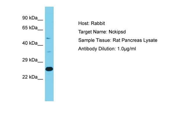 Polyclonal Rabbit anti-Rat NCKIPSD / AF3P21 Antibody (aa362-411, WB)