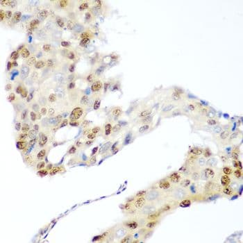 CDK1 / CDC2 Antibody