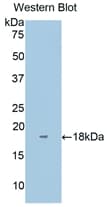 IL1RAP Antibody (aa420-558, PE)