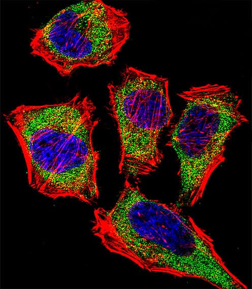 CA2 / Carbonic Anhydrase II Antibody (aa54-83)