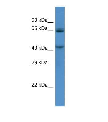 TMC7 Antibody (N-Terminus)