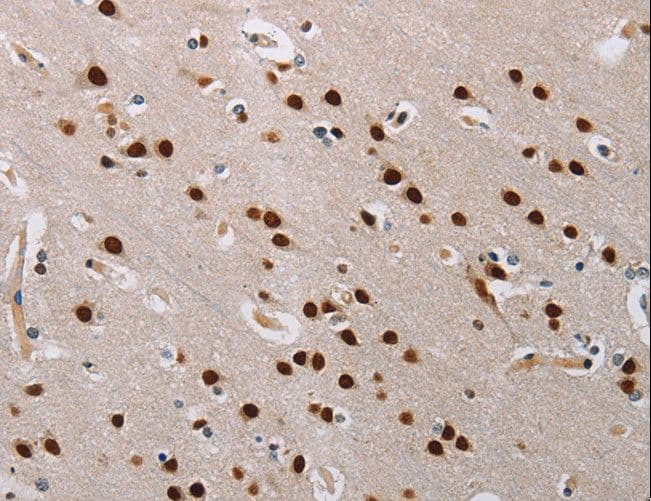 Polyclonal Rabbit anti-Human TONSL Antibody (IHC)