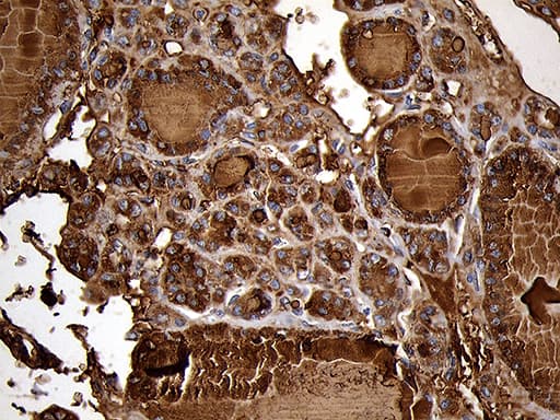 TG / Thyroglobulin Antibody (aa20-358, clone OTI2B9)