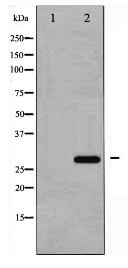 CDKN1B / p27 Kip1 Antibody (phospho-Thr187)