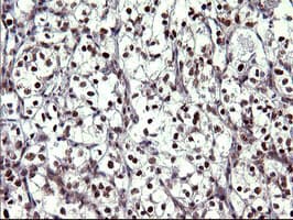 UPRT Antibody (clone OTI1A3)