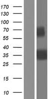Osteoglycin / Mimecan Protein (Over-Expression Lysate Myc-DDK (Flag))