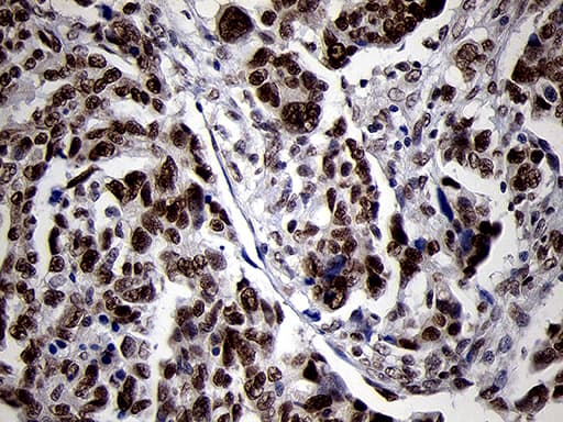 Monoclonal Mouse anti-Human SMC1A / SMC1 Antibody (clone OTI3G4, aa889-1016, IHC, WB)
