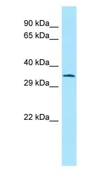 ATF5 Antibody (C-Terminus)