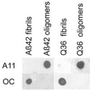 Polyclonal Rabbit anti-Human Amyloid Fibrils Antibody (IHC, WB)
