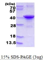 Human ARH / LDLRAP1 Protein (Recombinant His)