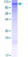 Human HSPH1 / HSP105 Protein (Recombinant GST)