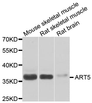 Polyclonal Rabbit anti-Human ART5 Antibody (IHC, WB)