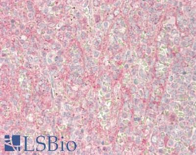 IHC-plus™ Polyclonal Rabbit anti-Human LTK Antibody (aa192-241, IHC, WB)
