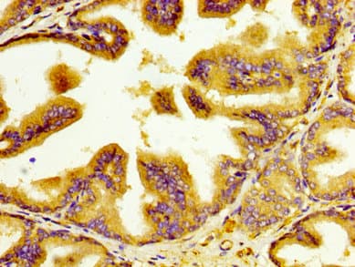 CRD-BP / ZBP1 / IGF2BP1 Antibody