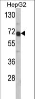 Alpha-Fetoprotein Antibody (aa56-85)