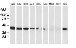 Monoclonal Mouse anti-Human ARFGAP1 Antibody (clone OTI1F6, IHC, IF, WB)