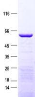 Human CCDC112 / MBC1 Protein (Recombinant His, N-Terminal)