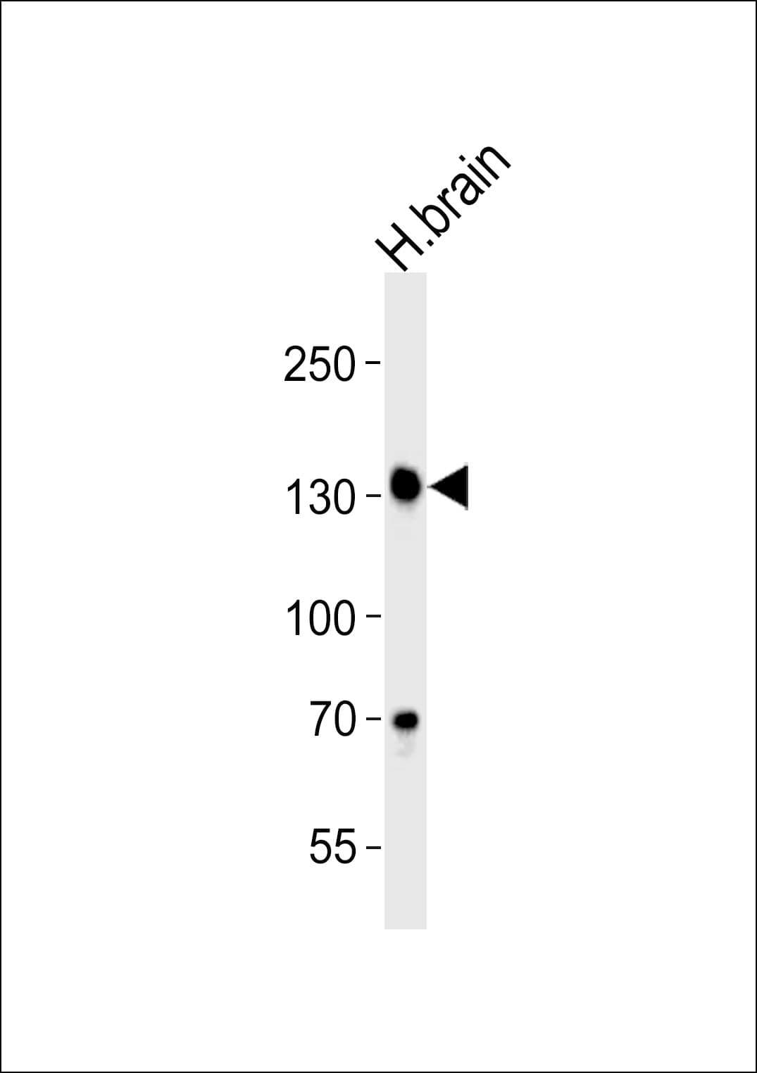 ZNF423 / OAZ Antibody (aa864-897)