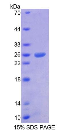 Human ARX Protein (Recombinant His-T7)