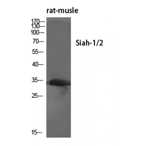 Polyclonal Rabbit anti-Human SIAH1/SIAH2 Antibody (160-240 aa, Internal, IHC, IF, WB)