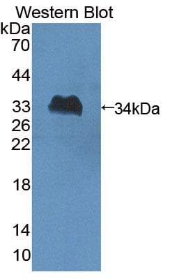 SLFN12L Antibody (aa658-891)