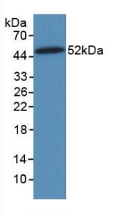 PathPlus™ Vimentin Antibody