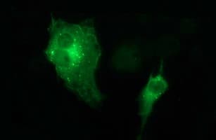 MAPK13 / p38delta Antibody (clone OTI2C7)