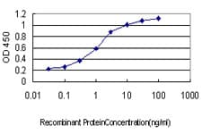 Monoclonal Mouse anti-Human CDC25A Antibody (clone 3D5, WB)