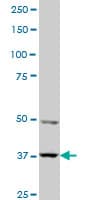 PBK / TOPK Antibody (clone 3A11)